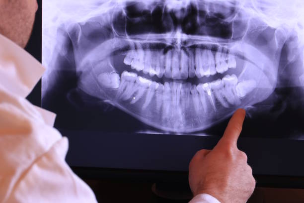 Best Orthodontic Emergency Dentist in East Orange, NJ