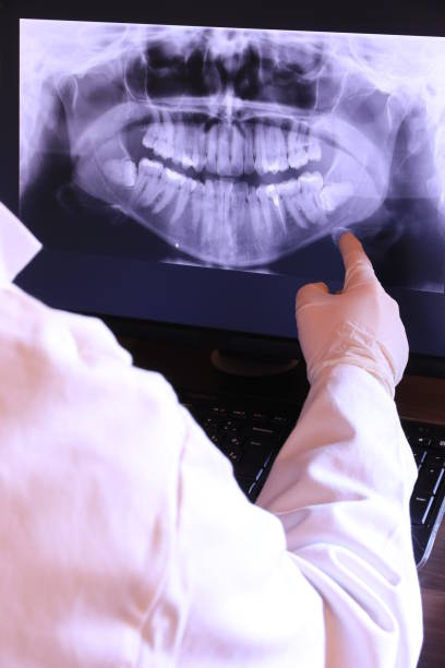 Best Emergency Dental Care for Abscessed Tooth in East Orange, NJ